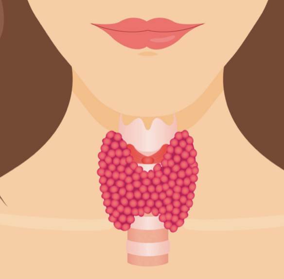 What is Thyroiditis - Dr Mohgah Elsheikh