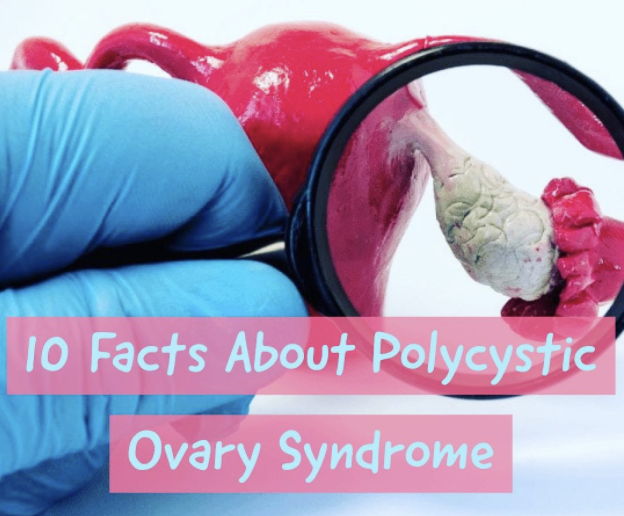 10 facts aboutPolycystic Ovarian Syndrome PCOS